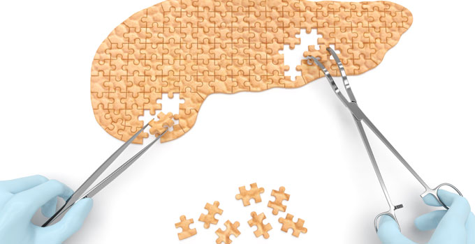 Pancreas missing knowledge